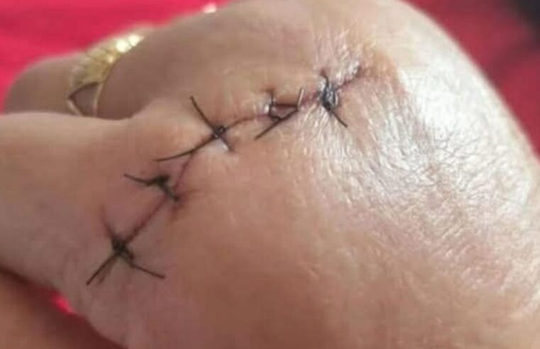 ALUNA DE 14 ANOS ATACA PROFESSORA COM FACA E AULAS SÃO SUSPENSAS EM ESCOLA DO RS