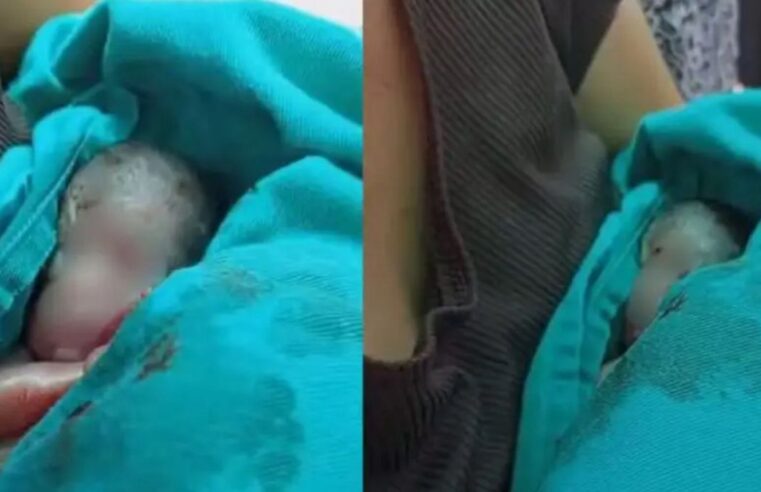 Recém-nascido declarado morto chora durante velório e é levado de volta ao hospital no Acre