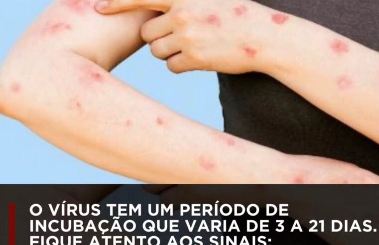 Porto Alegre confirmou mais um caso de Mpox em 2026 e colocou a Região Sul em alerta em pleno Carnaval, que termina amanhã. A doença é causada por um vírus do mesmo grupo da varíola. Em 2025, foram registrados 11 casos na capital gaúcha.