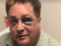 Leonardo sofre acidente durante pescaria no Pantanal e aparece com olho roxo