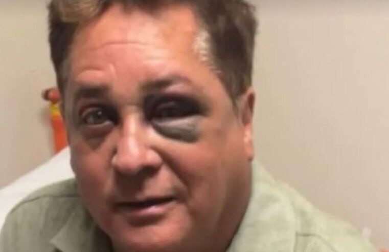 Leonardo sofre acidente durante pescaria no Pantanal e aparece com olho roxo